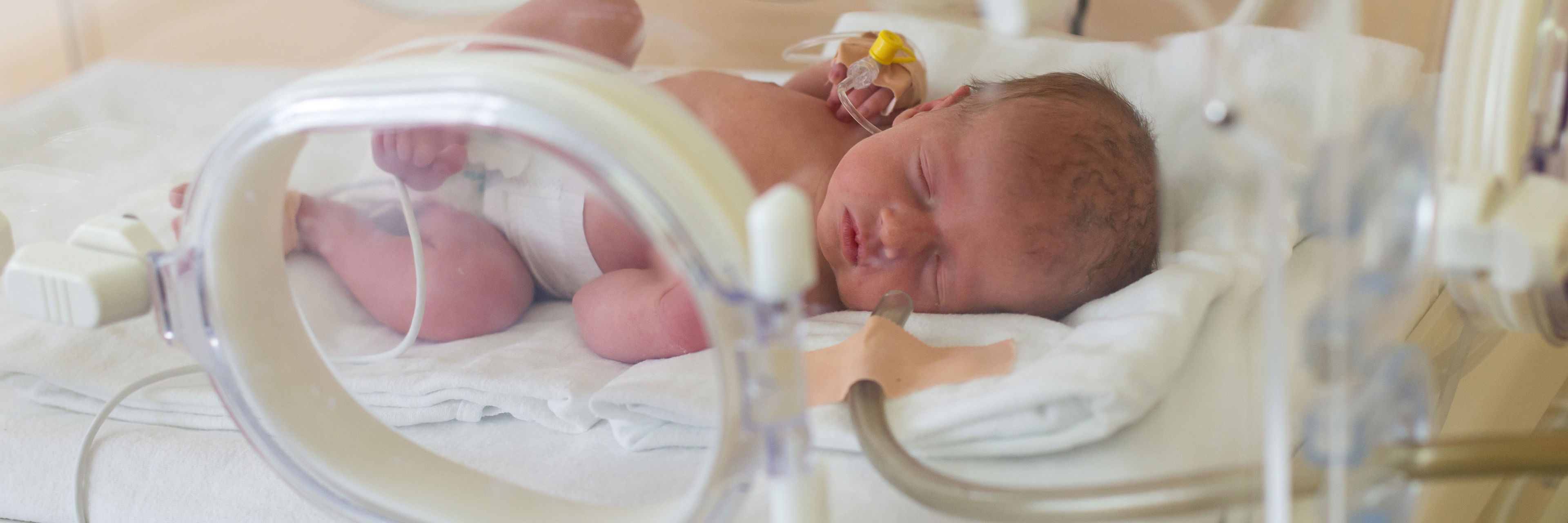 billede af en baby